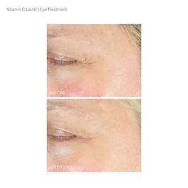 Vitamina C Lactic - Trattamento Contorno Occhi Luminoso